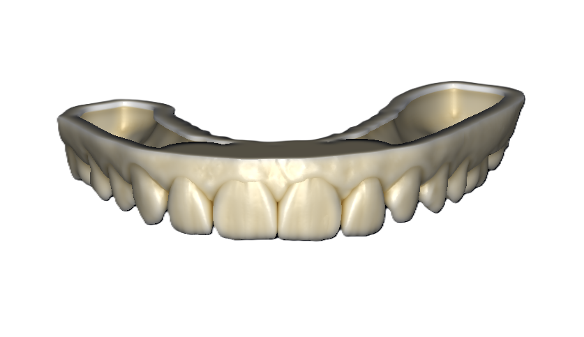 Mockup After