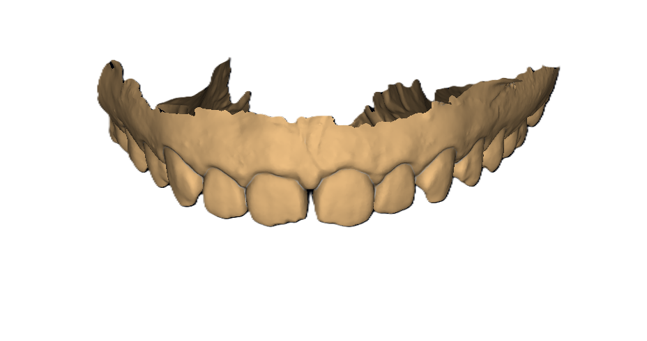 Mockup Before
